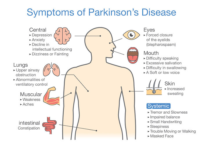 What is Parkinson’s disease? 7 things to know