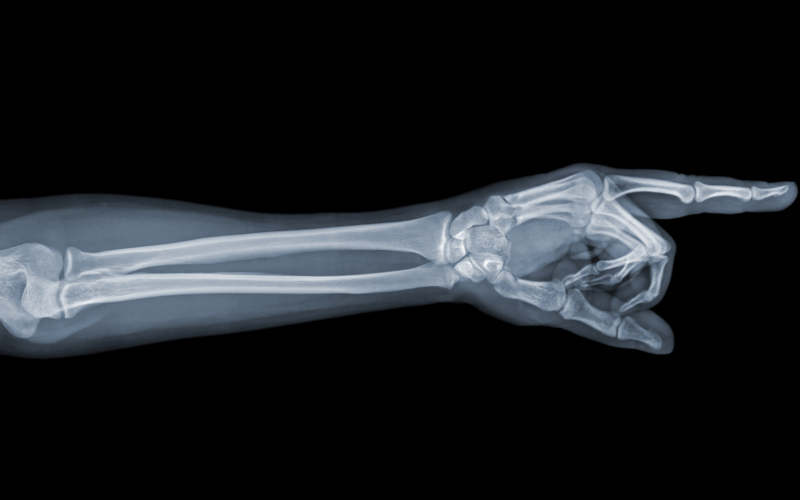 What’s Up Doc? Surgeon Tries To Sell X-ray As NFT